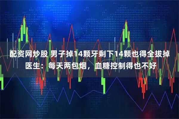 配资网炒股 男子掉14颗牙剩下14颗也得全拔掉 医生：每天两包烟，血糖控制得也不好